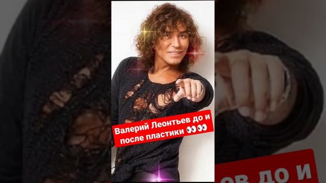 Вы даже не вспомните: вот как Леонтьев выглядел до операций смотреть онлайн