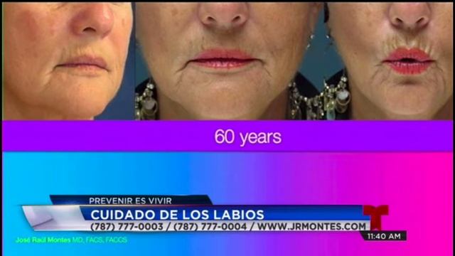 Labios Naturales Para Ella y Para Él - Dr Montes смотреть онлайн
