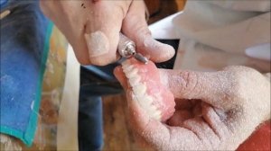 Изготовление и ремонт съёмных зубных протезов на дому