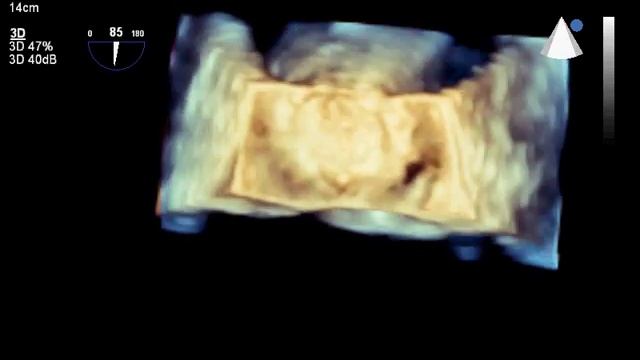 3d fist MVP1 смотреть онлайн