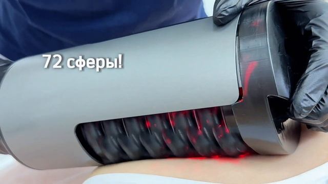 Сферотерапия Бьютилайзер. RSL массаж в салоне "Абрикосик" Москва смотреть онлайн
