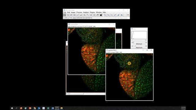 FIJI (ImageJ): Brightness & Contrast Enhancement смотреть онлайн