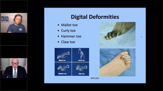 Common Foot Problems смотреть онлайн