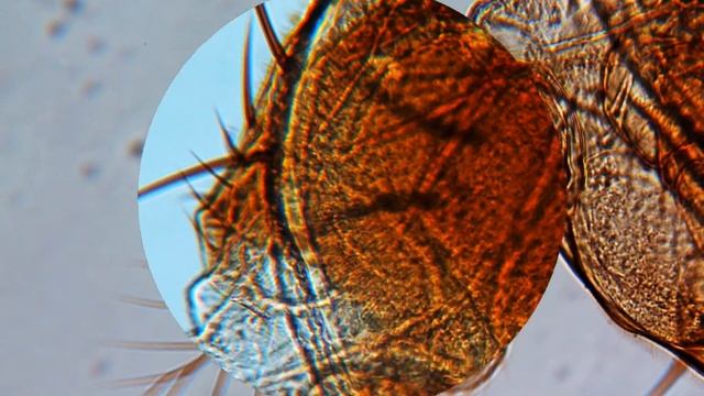 Taufliege (Drosophilidae) männlich - Mikroskop HD Video Deutsch смотреть онлайн