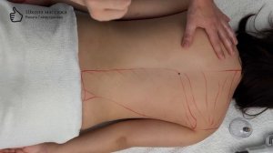 Баночный массаж спины