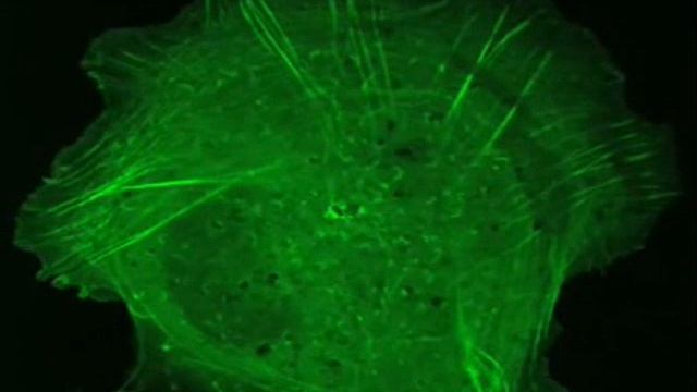 Active Illumination: Simultaneous FRAP of Complex Shapes - Andor Technology смотреть онлайн