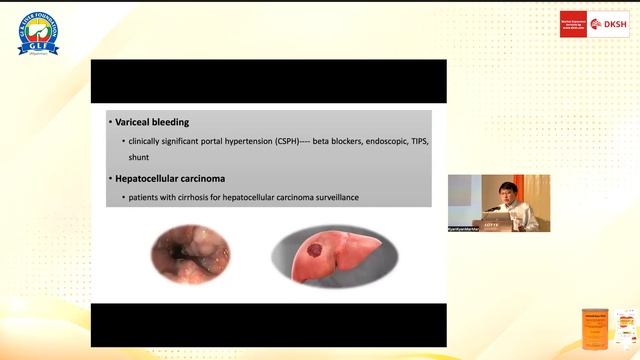 Comprehensive Symposium on Cirrhosis of Liver смотреть онлайн