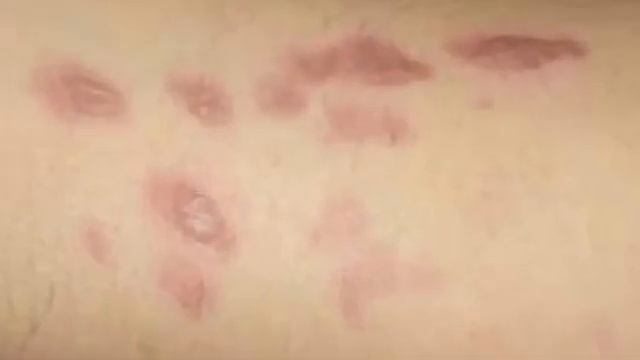 cream ek fayade anek soo or agr ap ko yeh buy karn hai to aap comment box m massage karye смотреть онлайн