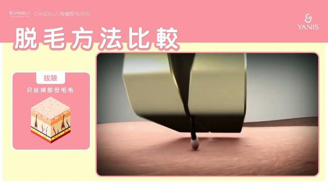 Yanis Beauty - 脫毛方法比較 смотреть онлайн
