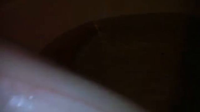 Моя лучшая поцарапала мне руку👋👿😿 смотреть онлайн