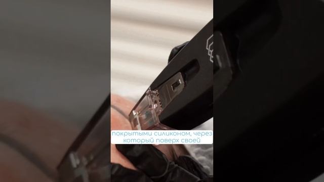 Микроигольчатый RF лифтинг Morpheus8 в Пятигорске смотреть онлайн