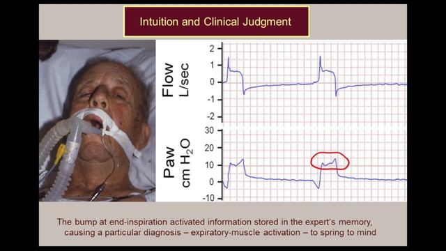 How to use Monitoring Data to make wise Clinical Decisions Martin Tobin