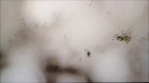 Бактерии ВОДА ЖИВАЯ И МЁРТВАЯ