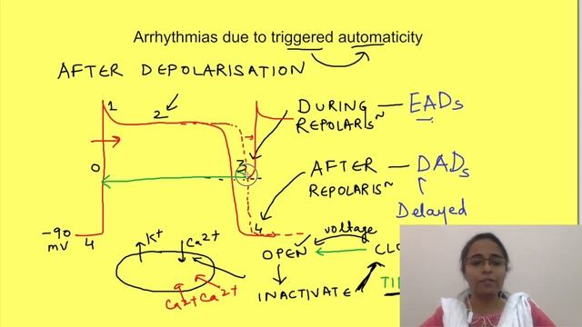 Mechanisms of cardiac arrhythmias | Tachyarrhythmias | Cardiovascular Pathophysiology | смотреть онлайн