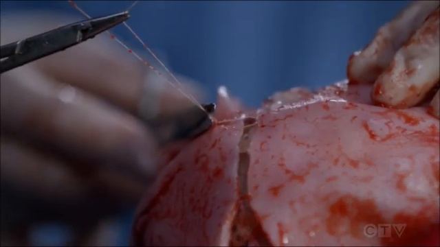 Grey's Anatomy s16e04 - I'll Stand By You - Natalie Tylor смотреть онлайн