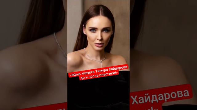 «Из провинциалки в королеву»: жена Хайдарова показала, как ее изменила пластика #shorts смотреть онлайн