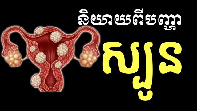 ប្រធានបទនិយាយពីបញ្ហាស្បូន បកស្រាយដោយលោកបណ្ឌិត ណូនី /CAM Health/ смотреть онлайн