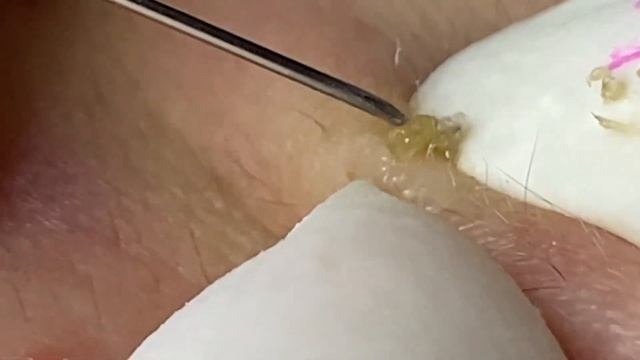 Enjoy Every Day With The Best Video Loan Nguyen Spa Official 2497 смотреть онлайн