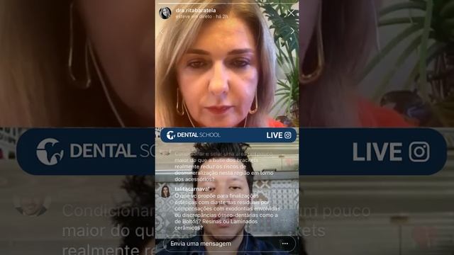 FINALIZAÇÃO ESTÉTICA EM ORTODONTIA - QUANDO E COMO FAZER? - DENTAL SCHOOL смотреть онлайн