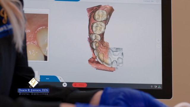 SureSmile - Damon R. Johnson, DDS | Edmond OK Dentist | Edmond Dentist | OKC Dentist смотреть онлайн