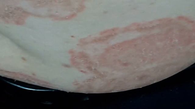 Tinea Corporis смотреть онлайн