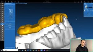 Обучение хирургическим шаблонам в программе RealGuide. Доработка модели, создание шаблона.