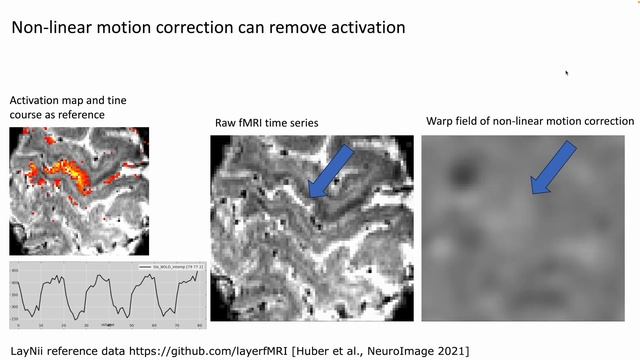 Renzo Huber: Ultra high resolution fMRI in the presence of motion смотреть онлайн