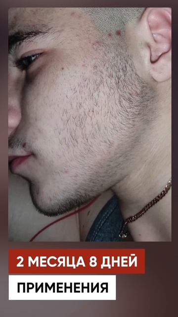 ОТ ПУШКА ДО СОЛИДНОЙ БОРОДЫ за 6 месяцев смотреть онлайн