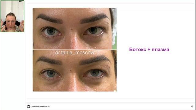 КРУГЛЫЙ СТОЛ С УСПЕШНЫМ КОСМЕТОЛОГОМ ТАТЬЯНОЙ ТЫМКО. Запись от 28.11.23 смотреть онлайн