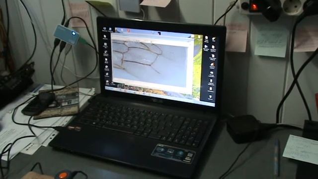 измеряем кубитальный индекс смотреть онлайн