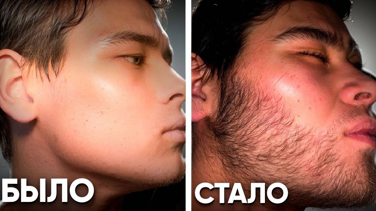 ОТКАТ ПОСЛЕ РЕЗКОЙ ОТМЕНЫ / Результаты Ксиноксина за 2,5 месяца смотреть онлайн