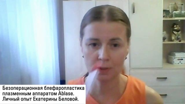 Клиенты о безоперационной блефаропластике. смотреть онлайн