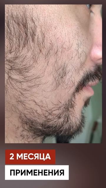 АЗИАТ ОТРАСТИЛ ШИКАРНУЮ БОРОДУ смотреть онлайн