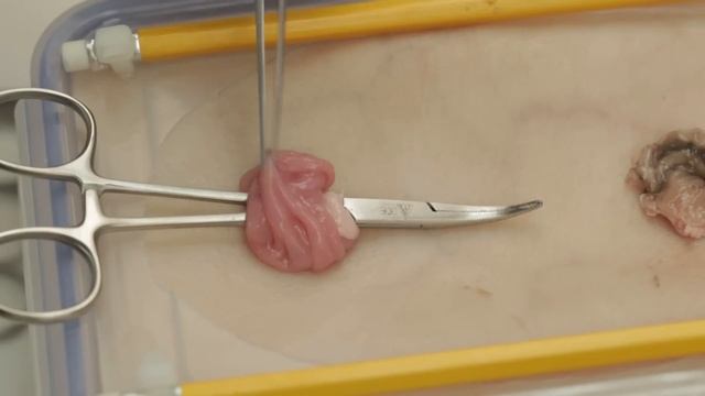 Colostomy and ileostomy formation (simulated) смотреть онлайн
