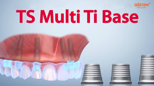 TS Multi Ti Base / Титановые основания смотреть онлайн