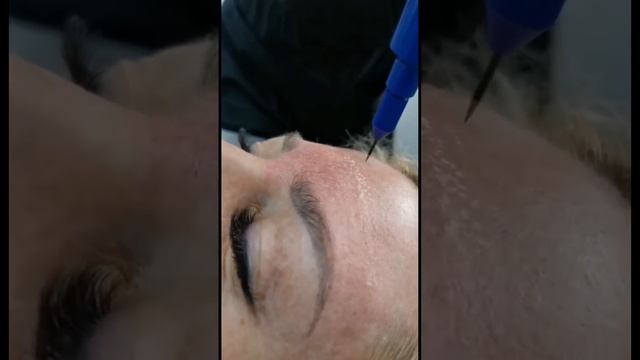 Процедура «Холодная плазма» в реабилитационном центре «Дамиан» 89374495111 Пенза смотреть онлайн