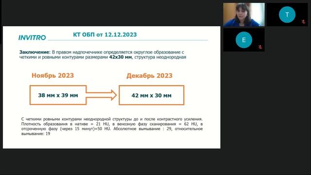 Акцент на деталях смотреть онлайн