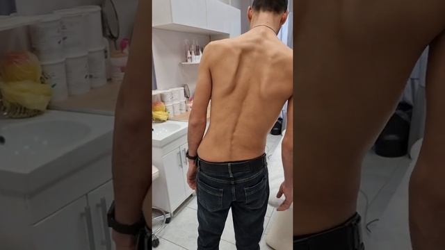 лечите грыжу вовремя! не доведите до тонкого состояния! и вам сложно и мне! смотреть онлайн