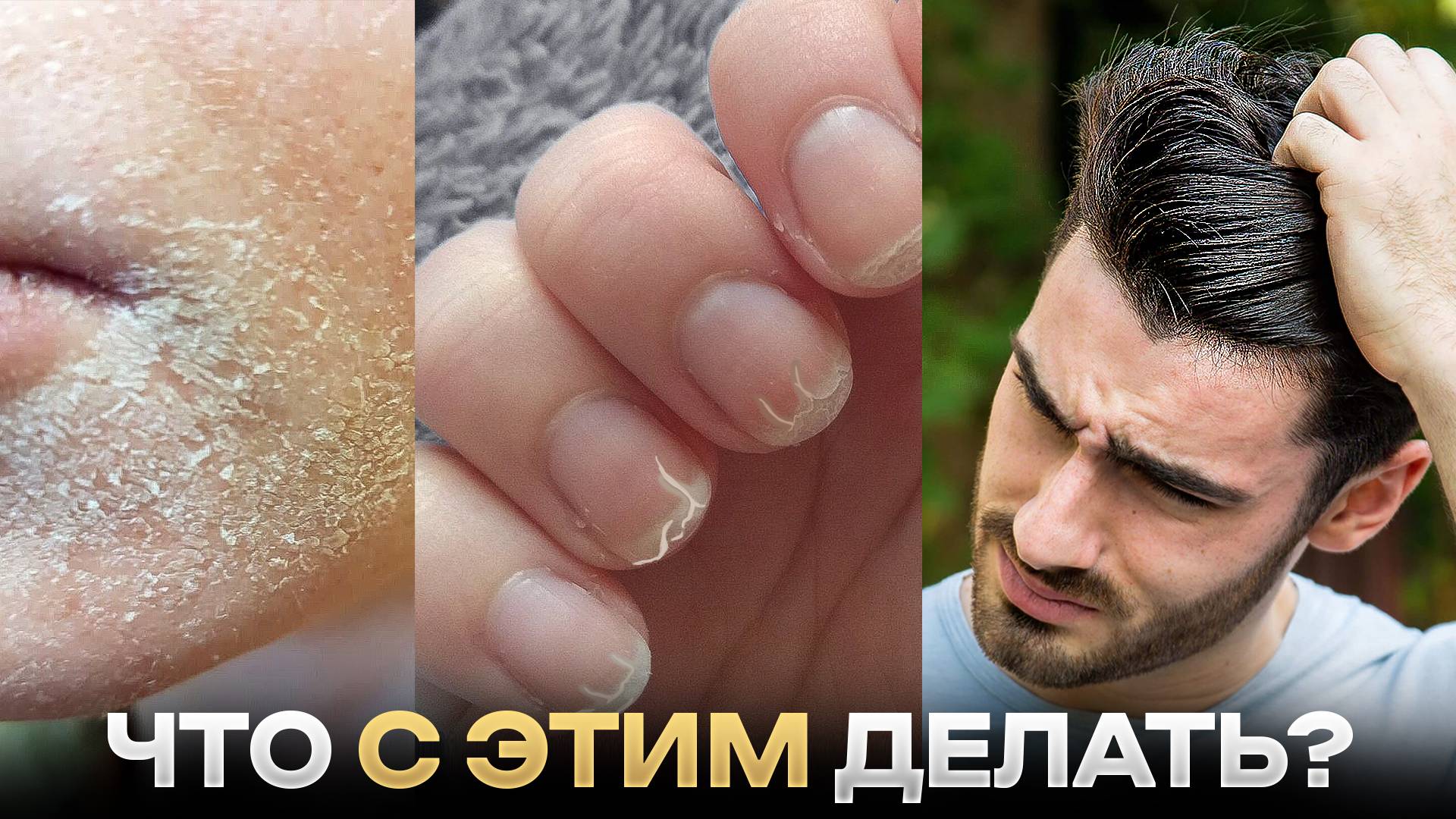 Слабые волосы, ногти и сухая кожа? Вот как это решается! смотреть онлайн