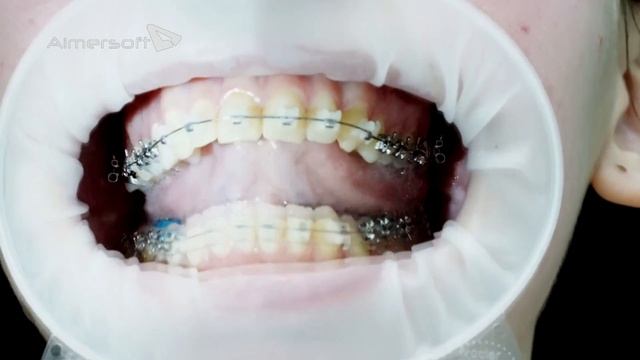 4 Функциональная проба Правая утка смотреть онлайн
