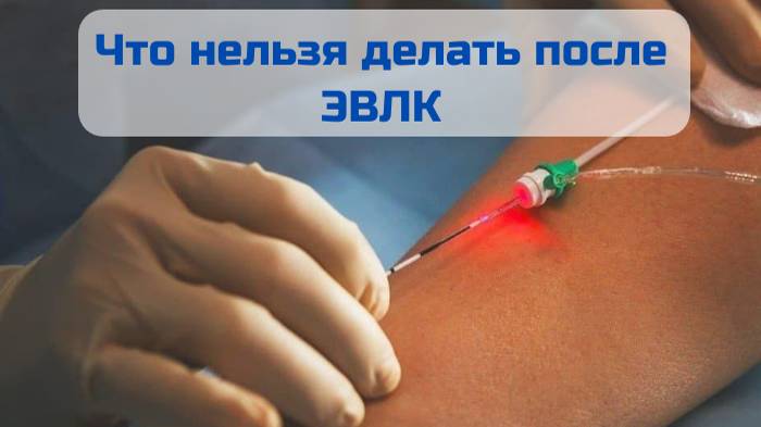 Что нельзя делать после ЭВЛК