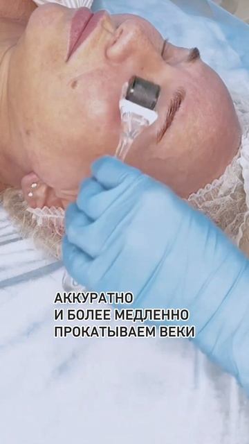 Как работать мезороллером, когда вы делаете пилинг? смотреть онлайн