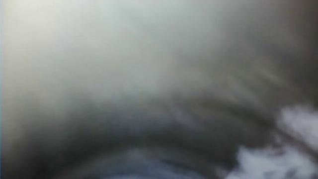 эндоскопия радиатора смотреть онлайн