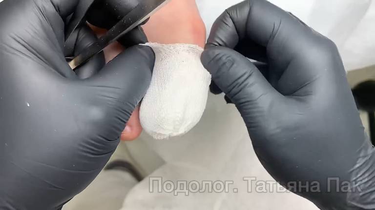 Где подолог и где маникюрщица | каждый должен работать в рамках своей компетенции | история пациента смотреть онлайн