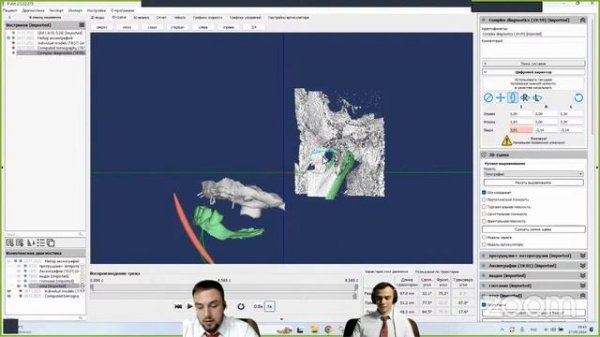 Стрим на тему: "Аксоиграфия при нефиксированном прикусе и планирование хирургических шаблонов"