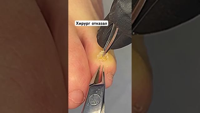 Медработник отказал в помощи #мозоли смотреть онлайн