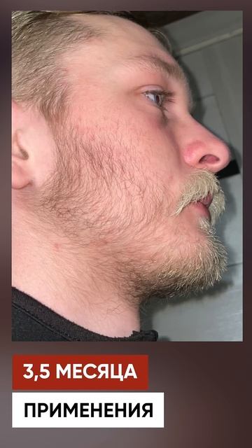 Отрастил ГУСТУЮ БОРОДУ с белыми волосами смотреть онлайн