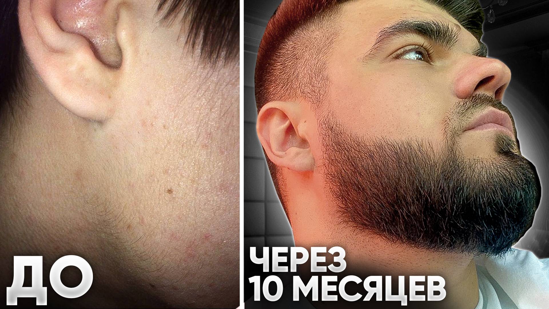 БРУТАЛЬНАЯ БОРОДА С НУЛЯ / Результаты средств для роста бороды