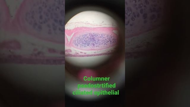 columner psedostrtified ciliated epithelial cell #mbbs #shortsmbbs #entertainment #enjoyment смотреть онлайн