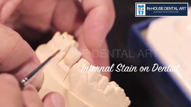 Internal Stain - In-House Dental Art смотреть онлайн